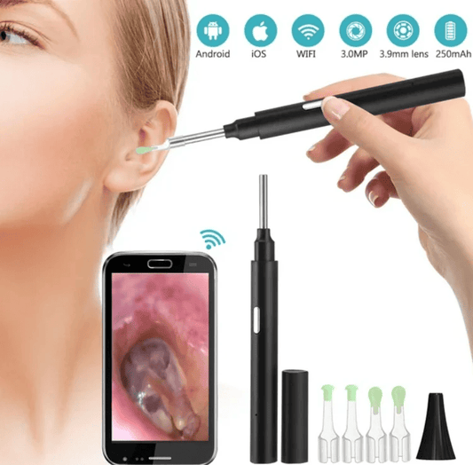 Otoscopio con Cámara HD Bluetooth
