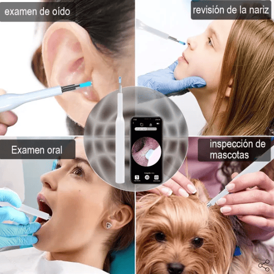 Otoscopio con Cámara HD Bluetooth